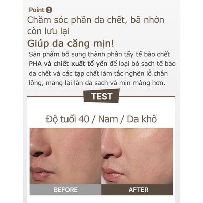Tẩy da chết / Gel tẩy tế bào chết ACSYS Peeling Gel 120ml