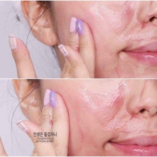 Serum Red peel Tingle gói 2,5ml