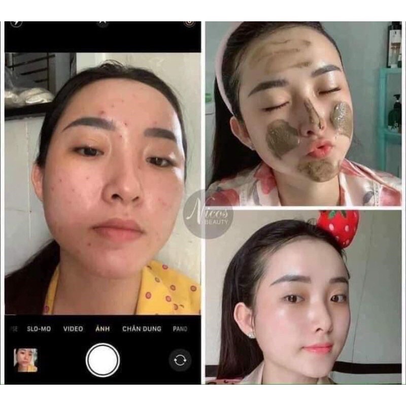 Sữa Rửa Mặt Đông Y Nicos