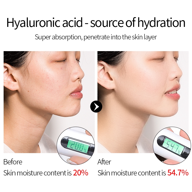 Tinh Chất Serum Dưỡng Ẩm LAIKOU Với Axit Hyaluronic 17ml/30ml