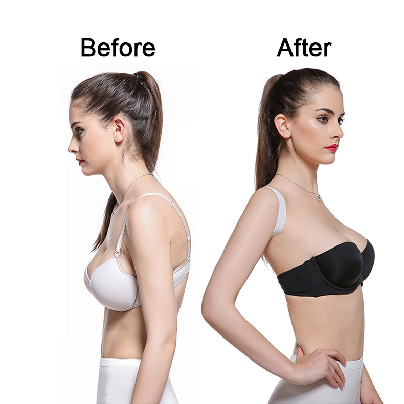 Đai đeo hỗ trợ điều chỉnh tư thế đúng hiệu quả