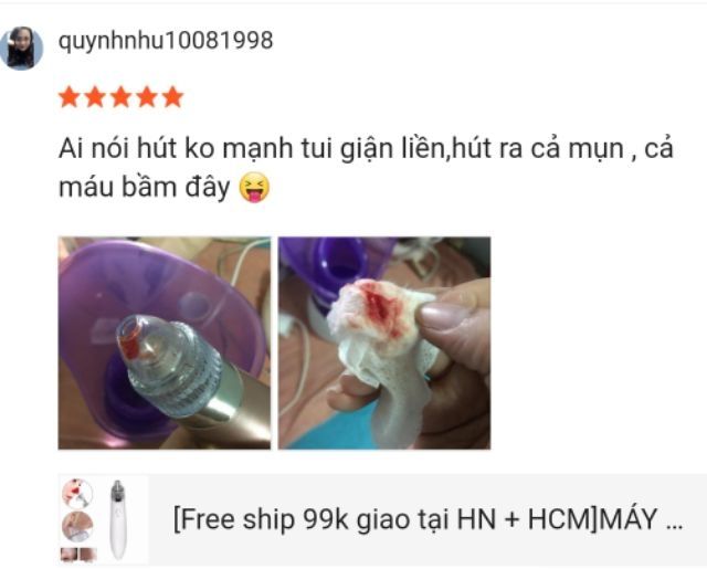 [Free ship]MÁY HÚT MỤN CAO CẤP 5 lực hút Sạc pin