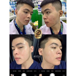 [Trợ giá bán Không lợi nhuận] Hoàng Thiên Sâm mạnh