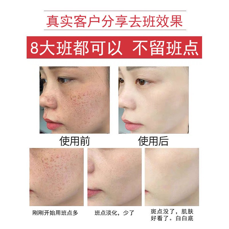 Herbal brightening skin rejuvenation freckle removing acne mask powder brightening whitening seven white seeds mask powd