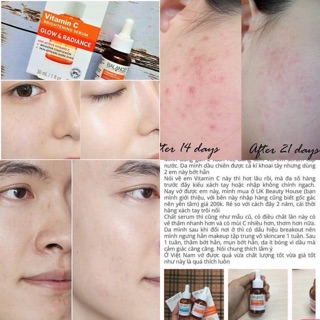 Tinh chất Balance Active Formula Vitamin C Power