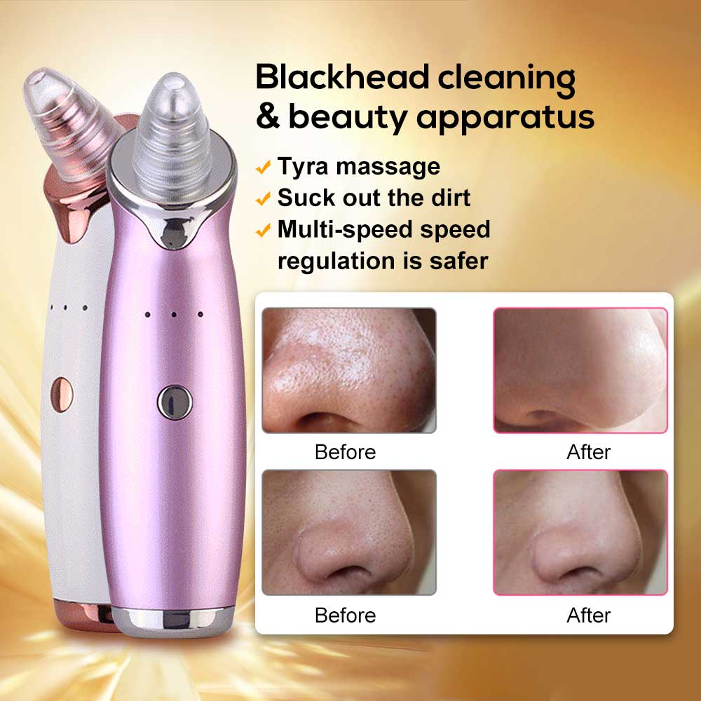 Máy hút mụn đầu đen SALORIE EMS làm sạch lỗ chân lông 5 trong 1 chuyên dụng