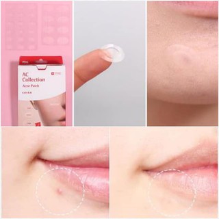 Miếng Dán Mụn Cosrx Acne pimple master Patch (24 miếng)