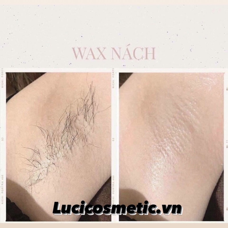 Combo nồi chống dính triệt lông sáp wax nóng 100gr ưwax nhập khẩu tặng mỡ trăn nguyên chất triệt lông nách,bikini,râu