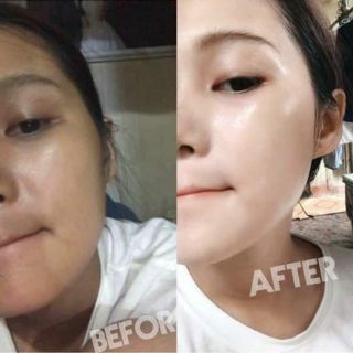 Kem Collagen 4k Plus Thái Lan loại 1