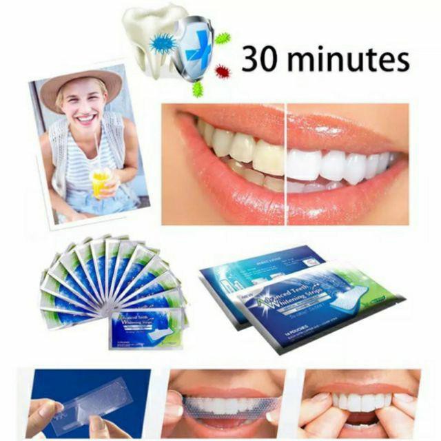 1 hộp 14 gói- 28 Miếng dán trắng răng chính hãng Mỹ- Advanced Teeth Whitening Strips