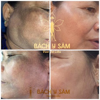 BÁCH Y SÂM 3 - BẠCH LINH 03 CHÍNH HÃNG (Mẫu Mới)