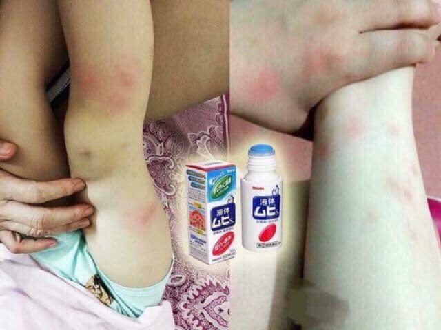 Lăn muỗi Muhi trị côn trùng đốt cho bé Nhật Bản | BigBuy360 - bigbuy360.vn