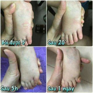 💥💥CAO BÔI MUỖI THÁI LAN
