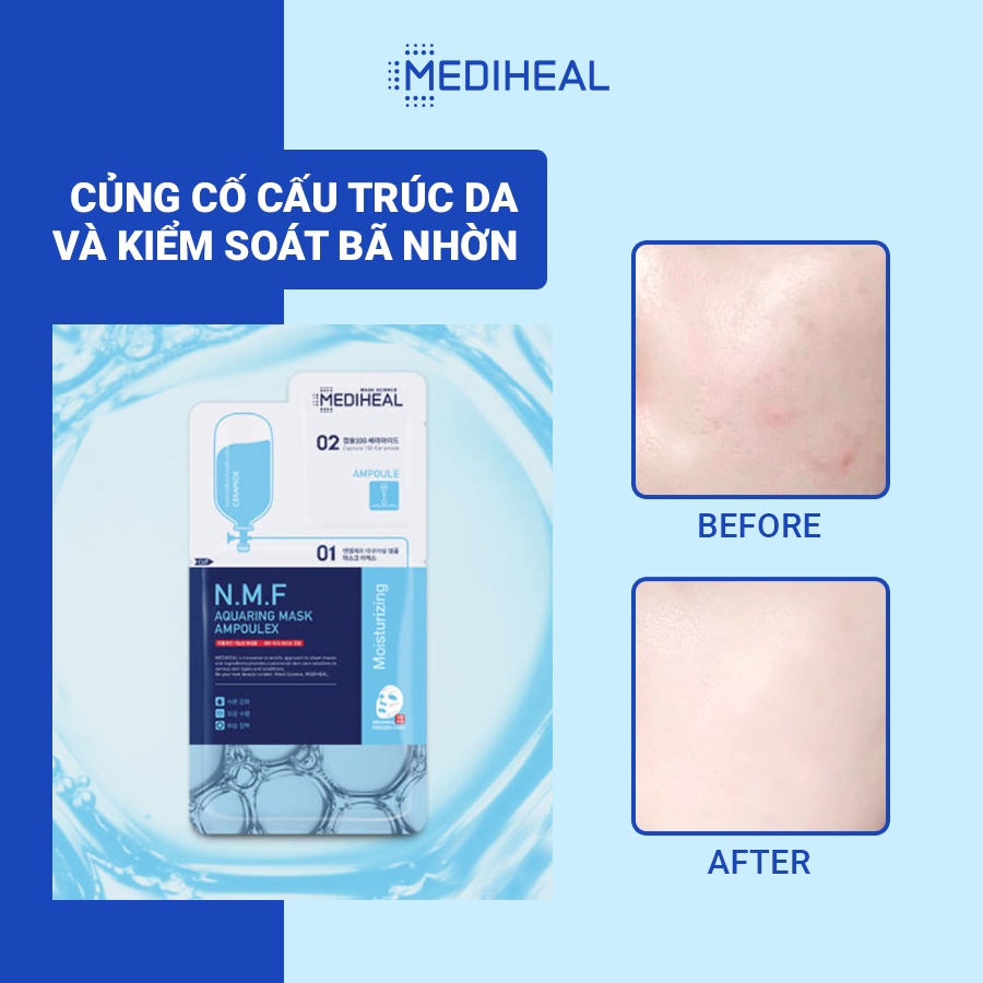 [Nhập mã COSMH22 giảm 8%] Mặt Nạ Mediheal Siêu Cấp Ẩm Phiên Bản 2 Bước N.M.F Aquaring Mask Ampoulex 30ML [K65]