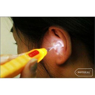 3 Dụng cụ lấy ráy tai có đèn