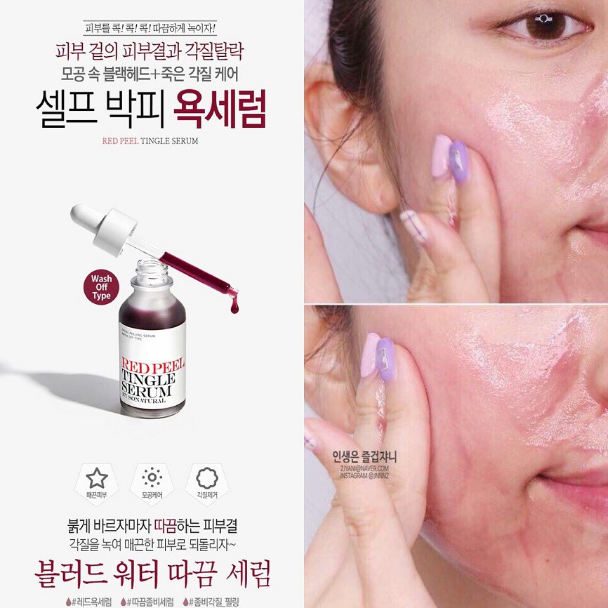 Red Peel Tingle Serum 35ml Tinh Chất Tái Tạo Da Chính Hãng