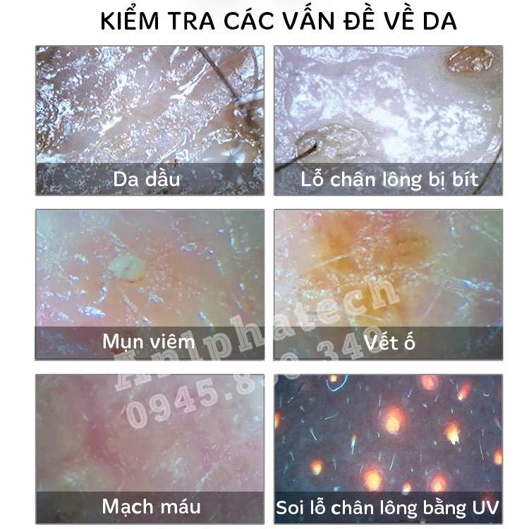 Máy Soi Da Ipad MEIBOYI, Máy Soi Da Mặt Đầu Phân Tích Da Có Màn Hình 11 Inch Cao Cấp Thế Hệ Mới 2023, Nhiều Chế Độ Soi