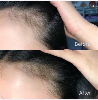 Tinh Chất Giúp Mọc Tóc Sato