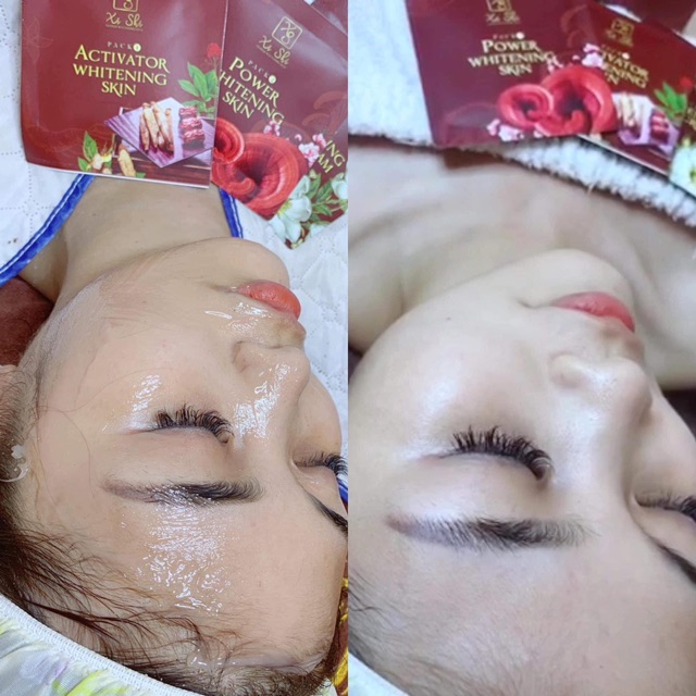 Ủ trắng face tây thi bạch y | BigBuy360 - bigbuy360.vn