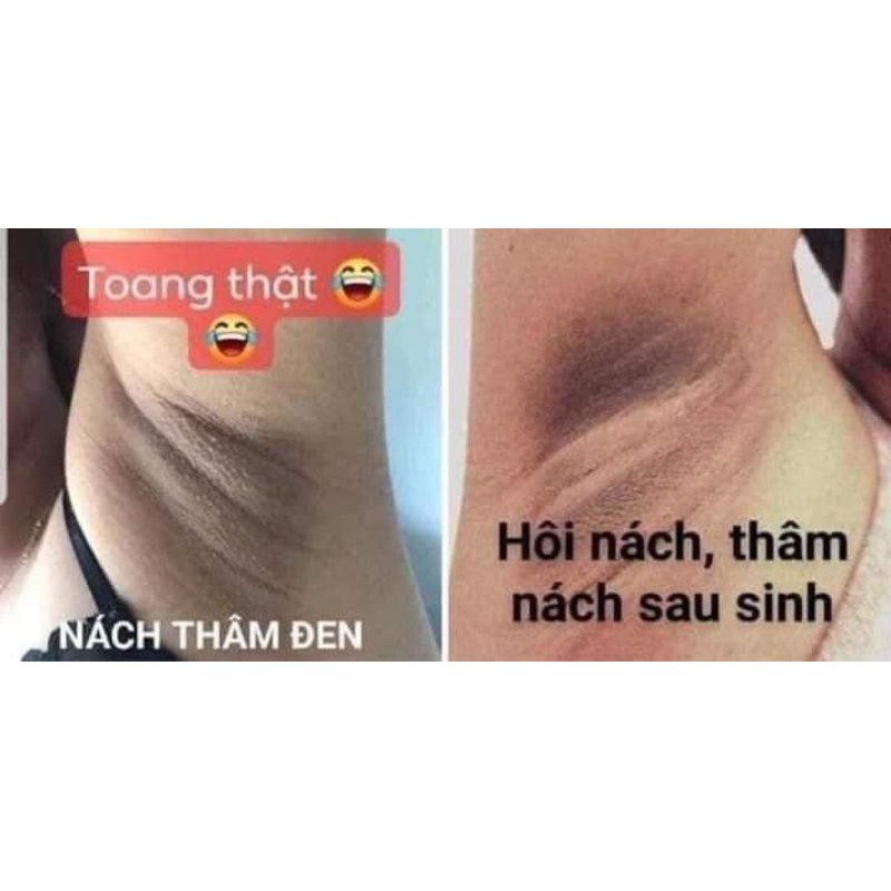 (TẶNG QUÀ XINH) COMBO 1 LỌ KEM LOẠI BỎ THÂM NÁCH - HÔI NÁCH CÔ BƠ | BigBuy360 - bigbuy360.vn