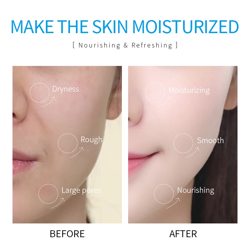 Lotion dưỡng da mặt xóa nếp nhăn dưỡng ẩm làm trắng da LAIKOU 100ml