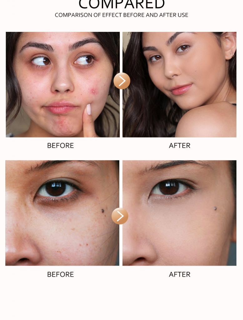 [Hàng mới về] Kem che khuyết điểm Minimeli che đi quầng thâm mụn tạo lớp trang điểm tự nhiên