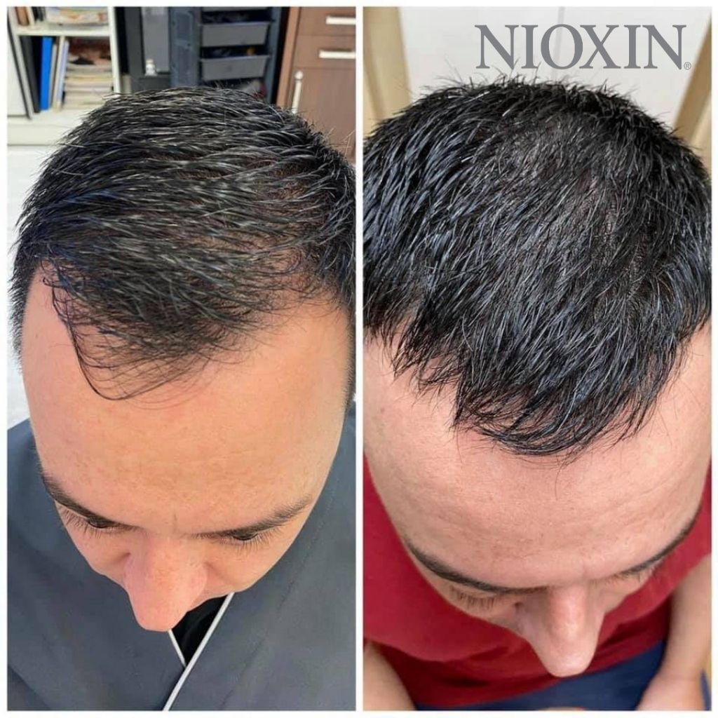 Dầu Gội NIOXIN 6 Cho Tóc Hay Tạo Kiểu, Thưa Mỏng Và Rụng Nhiều Trong Thời Gian Dài Cleanser Chemically Treated Hair 1L