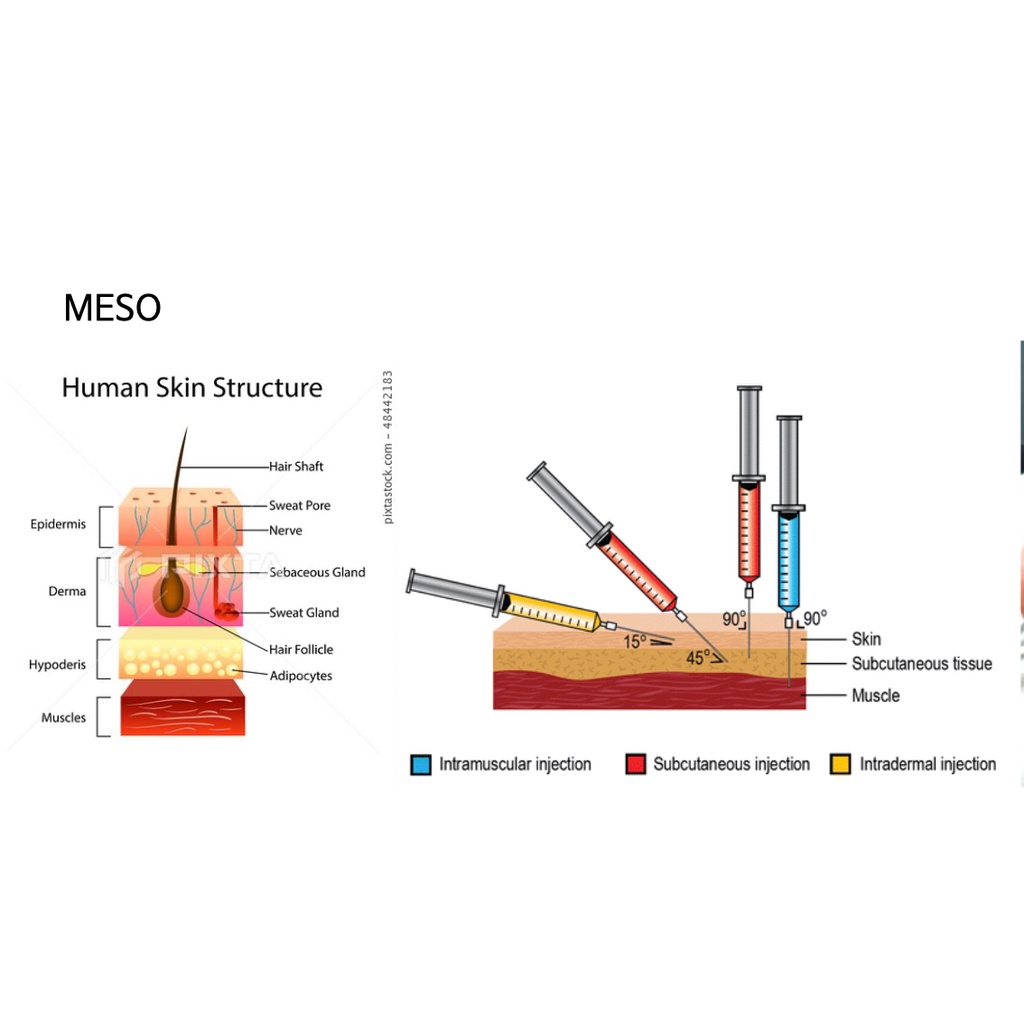 1 ống Moisture Solution Mesotherapy - Tinh chất I.ST AQUA HA 2.0 căng bóng da  2ml Hàn Quốc cấy meso