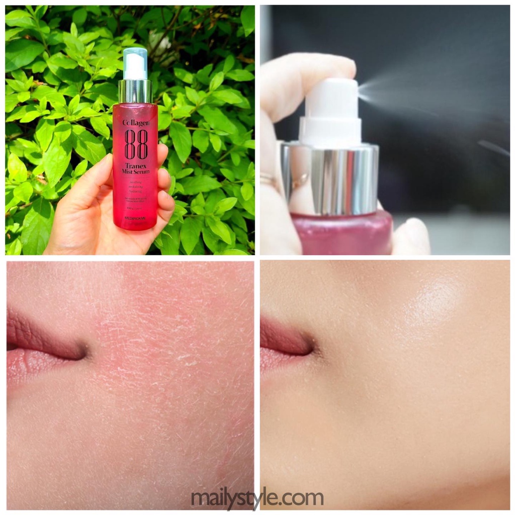 SERUM DẠNG XỊT 88% COLLAGEN CỦA MEDIPICKME GIẢM NÁM-LÀM TRẮNG DA | BigBuy360 - bigbuy360.vn