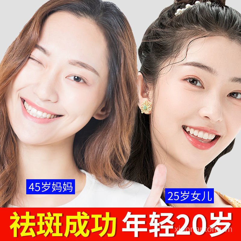 Bộ năm sản phẩm dưỡng ẩm làm trắng da loại bỏ tàn nhang hiệu quả