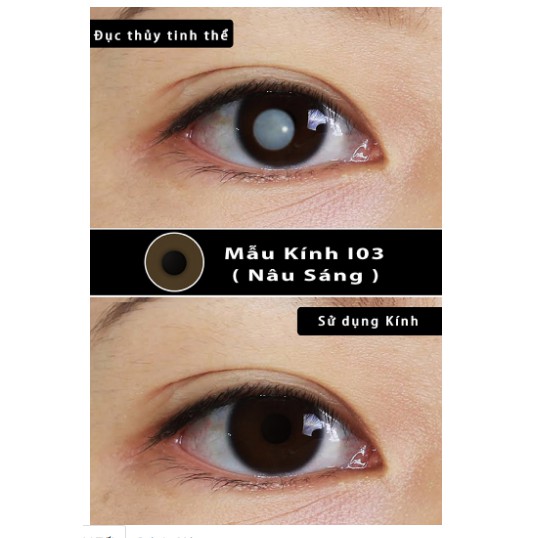 Kính áp tròng thẩm mỹ Qeye, lens che tật thị (che khuyết điểm) xuất xứ Hàn Quốc