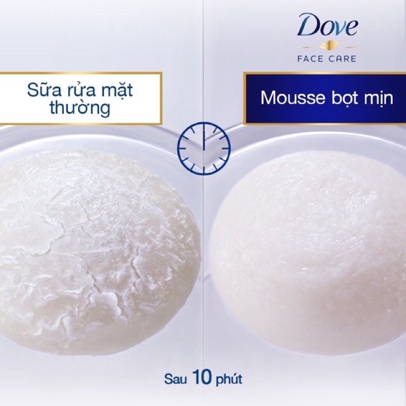 TRỢ GIÁ SỮA RỬA MẶT DẠNG BỌT DOVE 160ml giá bìa 195k/ chai tặng kèm km