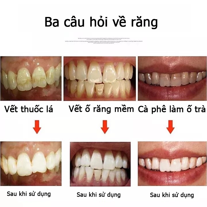 BAIMISS Bọt Tẩy Trắng Răng  Làm Sạch Răng Khử Mùi Hôi Miệng Mousse  Teeth Whitening Clean Teeth 60ml