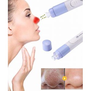 Máy hút mụn đầu đen mini