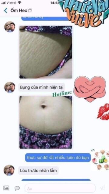 Mutil16 Trị Rạn Cao cấp