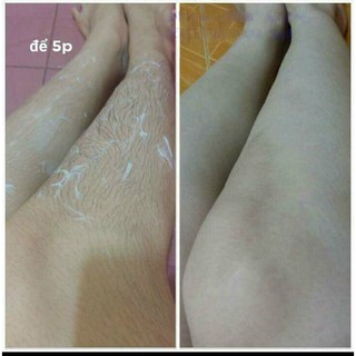 Kem Tẩy Lông Cherry MWhite 80ml