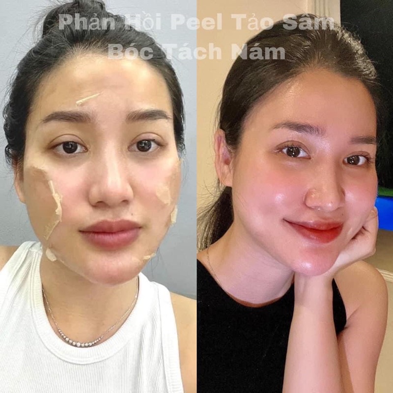 Feel Thay Da Mới Tảo Sâm MEEA - Tái Tạo Không Sưng Đỏ Da.