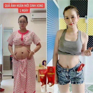 [CHÍNH HÃNG] KEM TAN MỠ QUẾ X2 OLIC (kèm thẻ bảo hành,...)