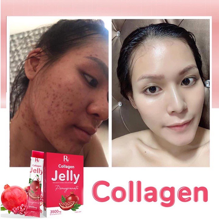 Thạch Lựu Trắng Da Toàn Thân Jelly Pomegranate Thụy Sĩ Chính Hãng