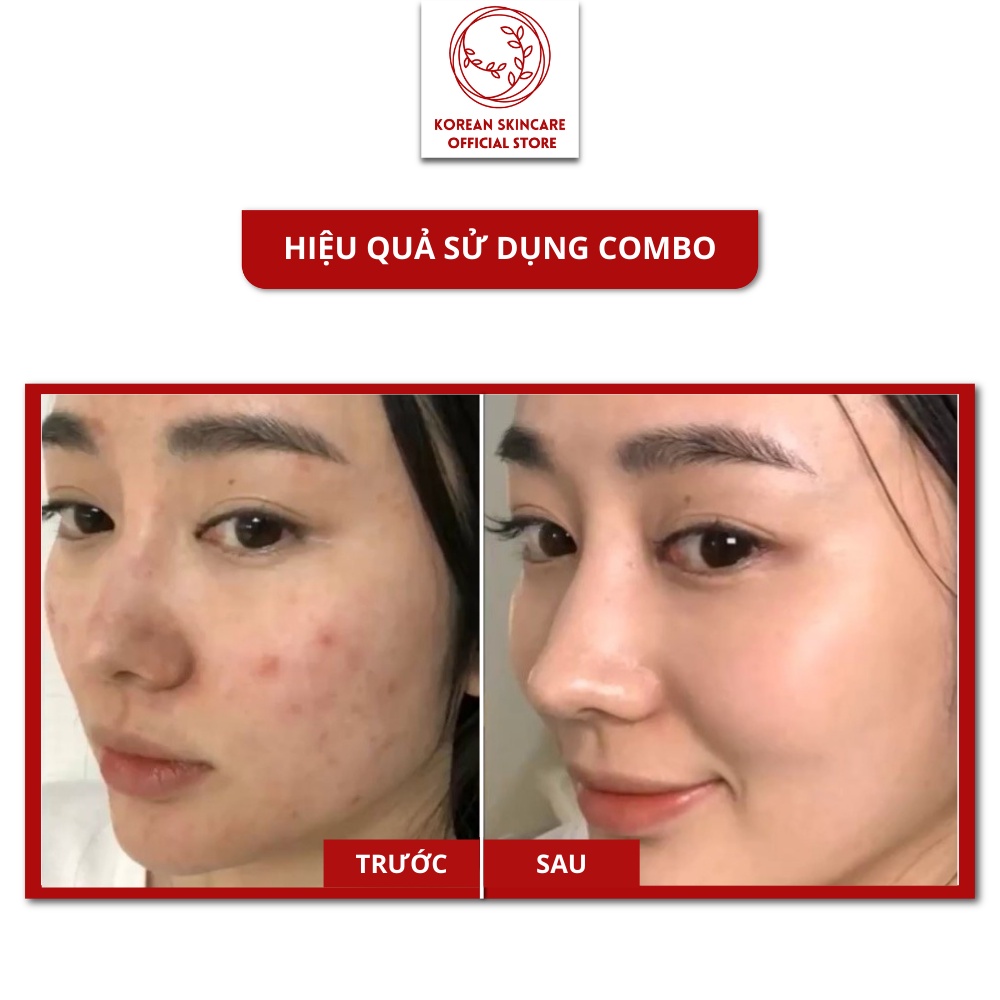 Combo Nước tẩy trang Celderma Micellar Cleansing Water 500ml và Viên Collagen tươi Multi Vita Capsule Ampoule JM 38 viên