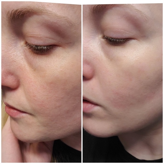 Tinh chất tẩy da chết BIOSSANCE Squalane + 10% Lactic Acid Resurfacing Night Serum