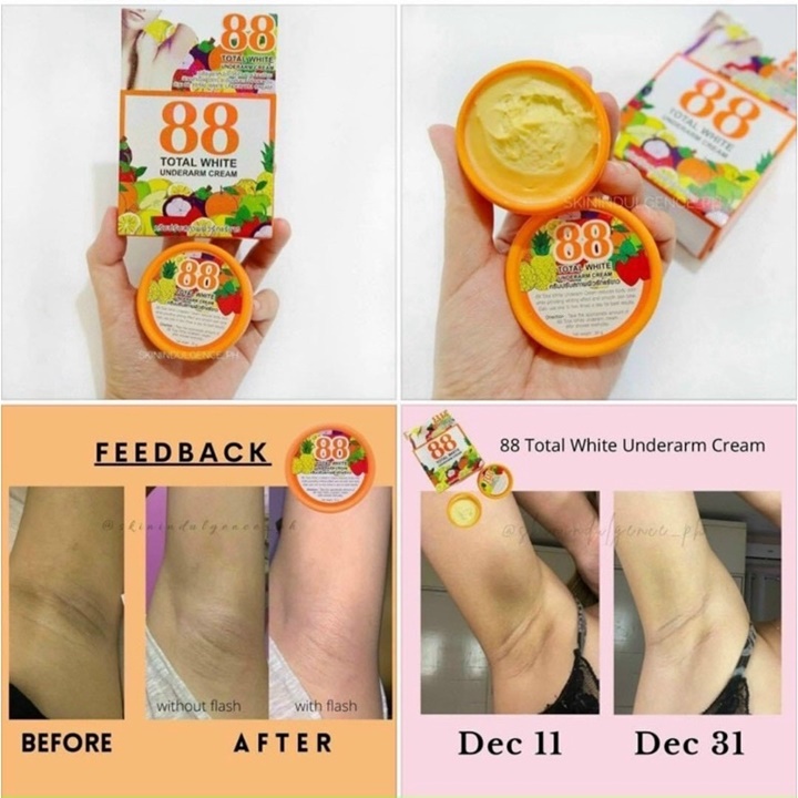 [Sỉ-Rẻ] Kem Khử Thâm Nách 88 TOTAL WHITE Thái Lan Khử Thâm , Trắng Mịn Hiệu Quả – HUKB755 [Lẻ-Sỉ]