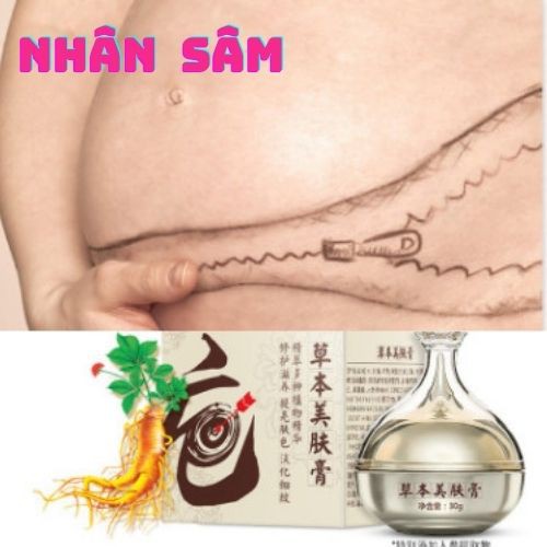 [ Mới ] Kem Làm Mờ Rạn Da Mẹ Bầu và Sau Sinh “Nhân Sâm” Cao Cấp, Nội Địa Trung 30gr.