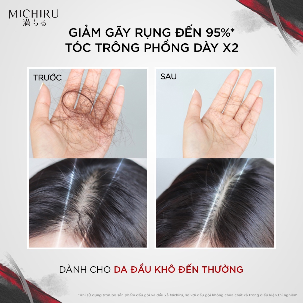 Bộ Gội Xả Michiru Ngăn Gãy Rụng & Làm Dày Tóc Dành Cho Da Đầu Thường Và Khô(Gội 180gr+Xả 180gr)