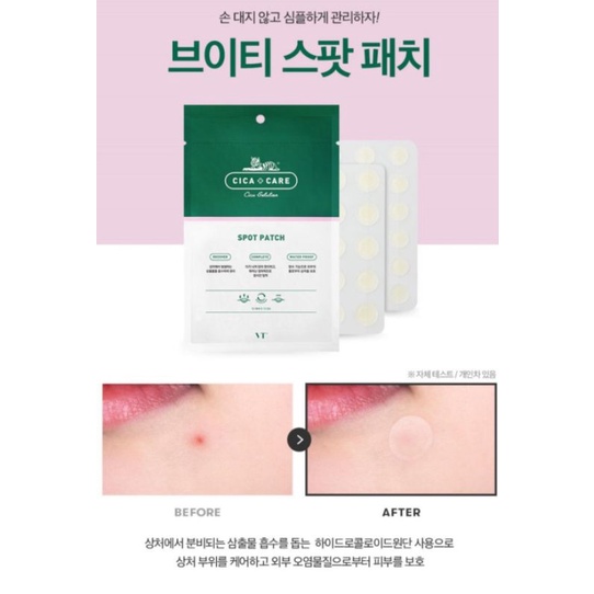 MIẾNG DÁN NGỪA VÀ CHE MỤN MỦ-VẾT THƯƠNG LASER 1 PATCH 48 MIẾNG
