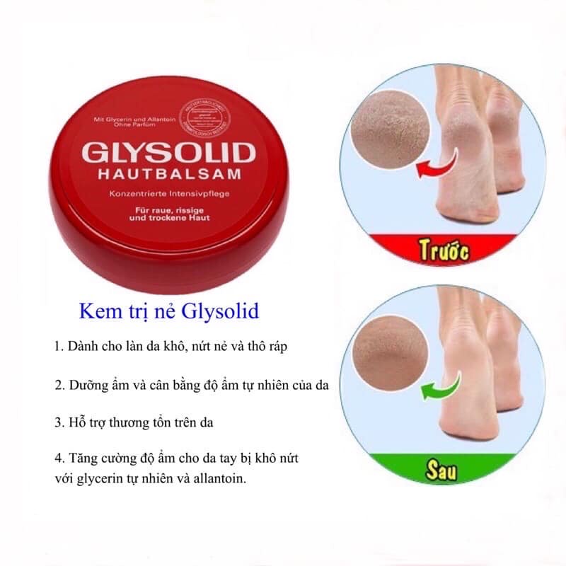 Kem GLYSOLID - Hàng Nội Địa Đức
