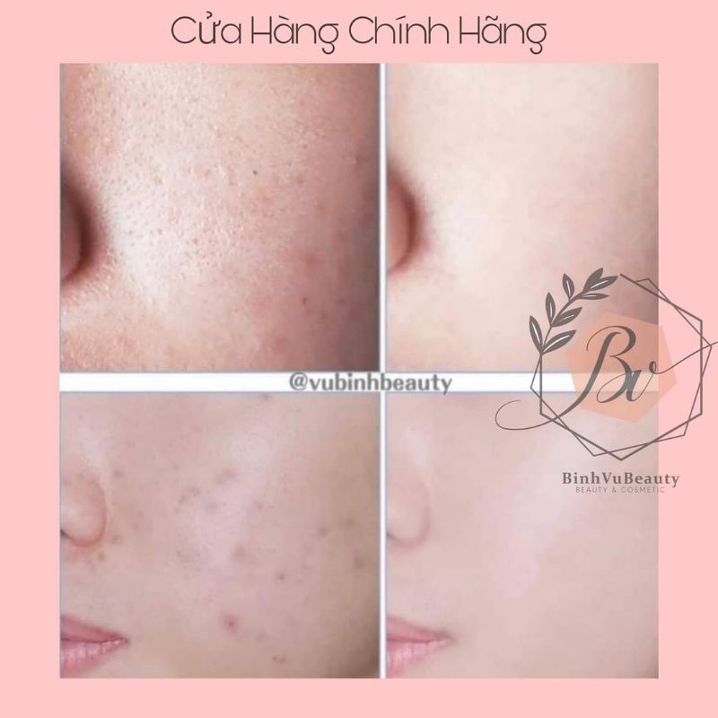 VIÊN UỐNG TRẮNG DA HUỶ NÁM mela for you PP68