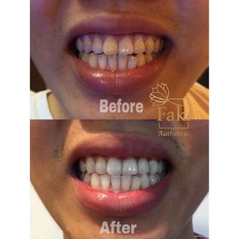 Miếng dán trắng răng hiệu quả 12 tháng Crest 3D White , Mỹ Miếng dán trắng răng cấp tốc, chống ê buốt cho răng nhạy cảm