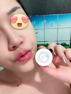 TẨY TRÉ BÀO MÔI PHUTAWAN