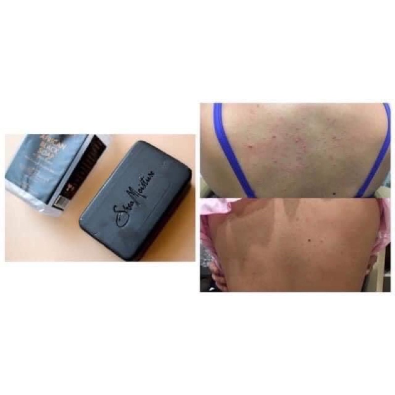 XÀ BÔNG ĐEN Shea Moisture 230g